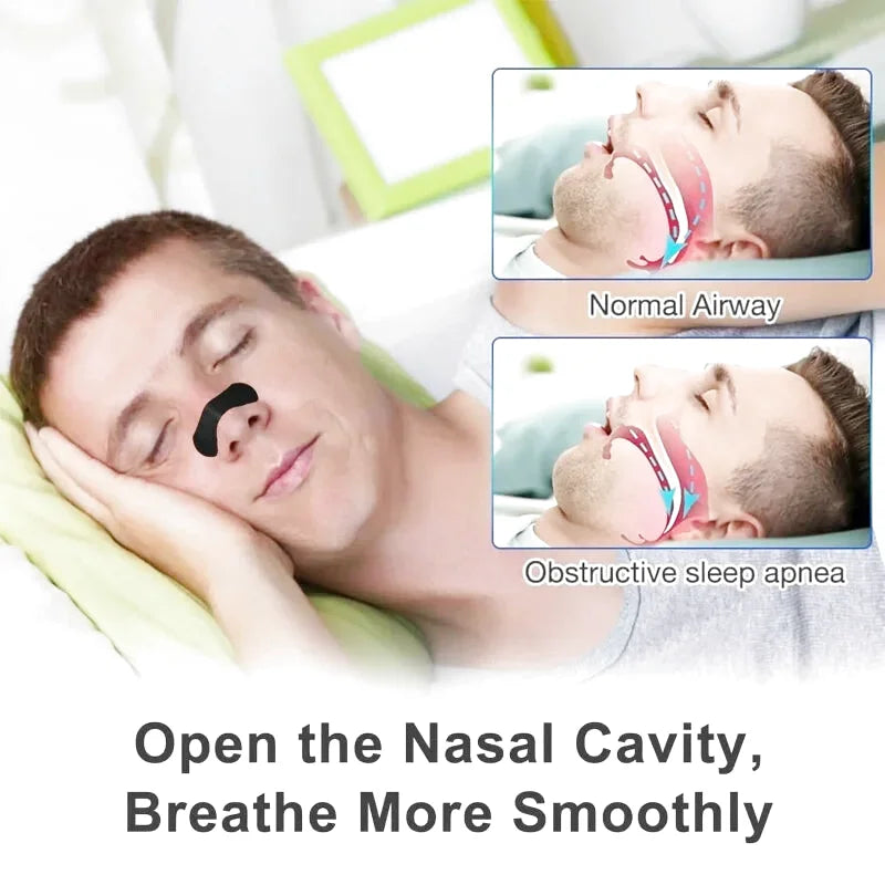 Dilatateur Nasal
